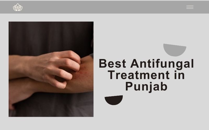 Best Antifungal Treatment in Punjab