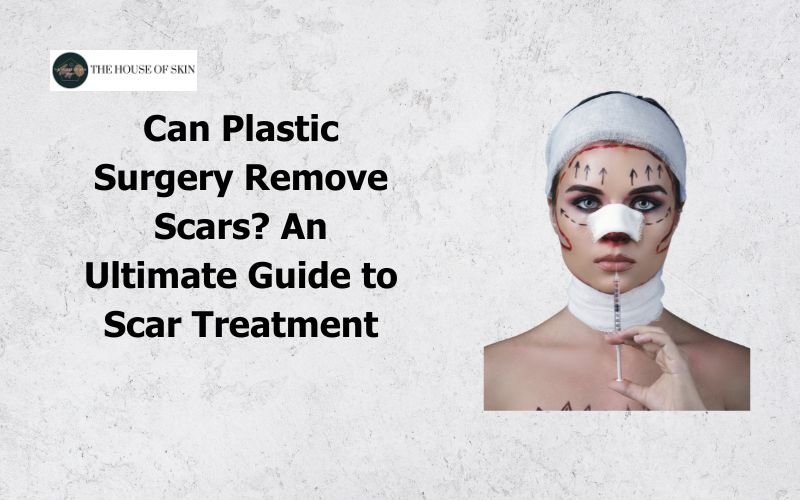 Can Plastic Surgery Remove Scars An Ultimate Guide to Scar Treatment