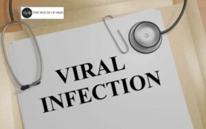 viral infection doctor in ludhiana