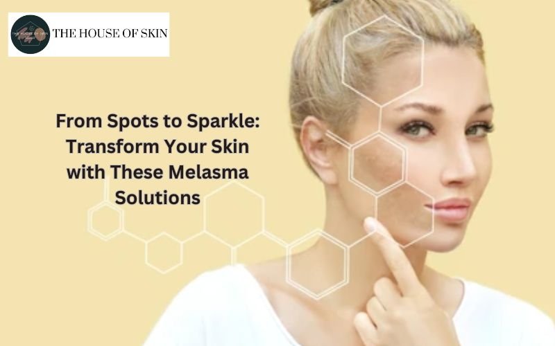 Best Melasma Treatments in Ludhiana