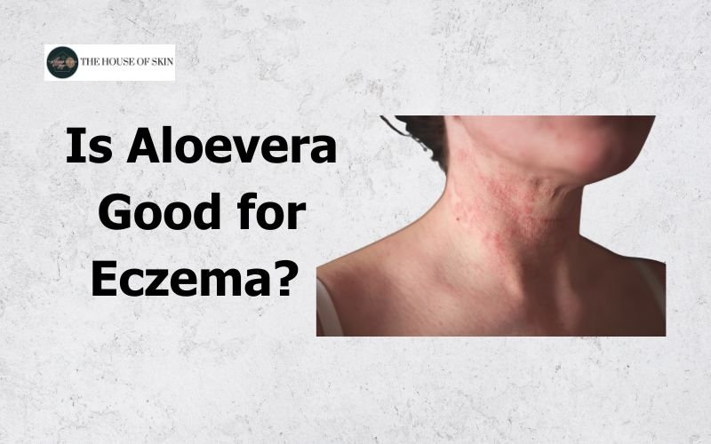 Is Aloevera Good for Eczema