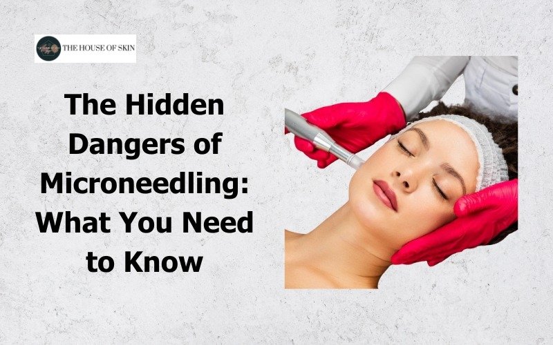 The Hidden Dangers of Microneedling What You Need to Know