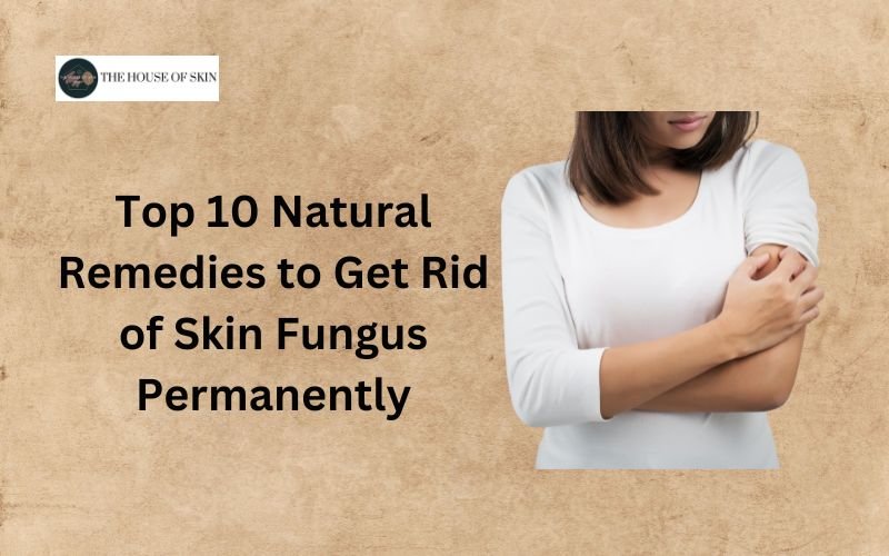 Top 10 Natural Remedies to Get Rid of Skin Fungus Permanently