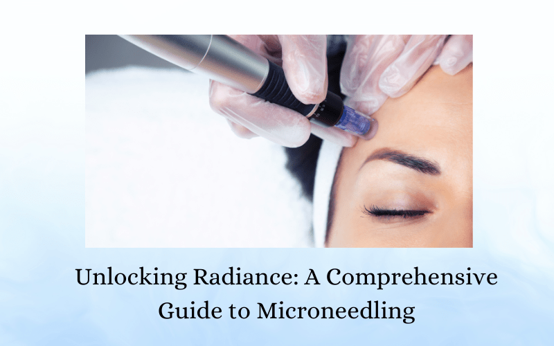 Unlocking Radiance A Comprehensive Guide to Microneedling