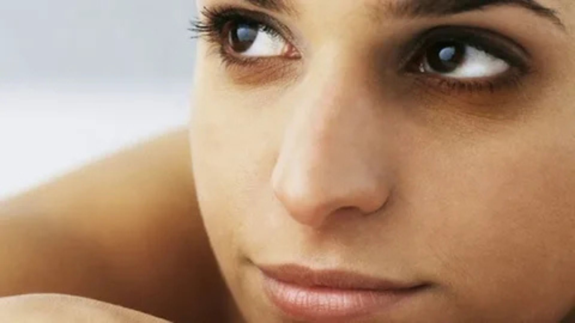 How to Remove Dark Circles Under Eyes Permanently