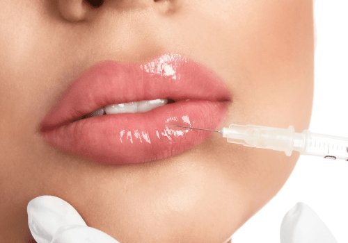Lip Pigmentation